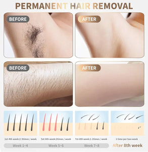 Home Use Beauty Device IPL Laser Hair Removal for Women and Men,999999 Flashes at-Home Laser Hair Removal Device