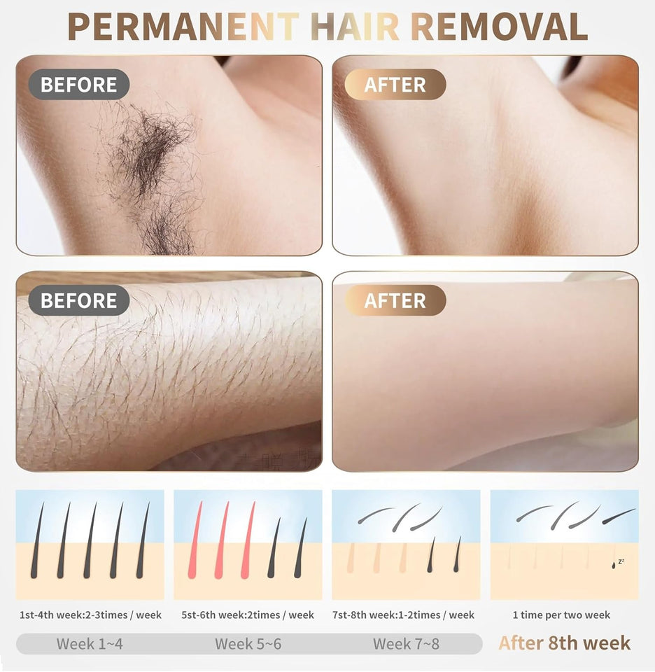 Home Use Beauty Device IPL Laser Hair Removal for Women and Men,999999 Flashes at-Home Laser Hair Removal Device