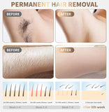 Home Use Beauty Device IPL Laser Hair Removal for Women and Men,999999 Flashes at-Home Laser Hair Removal Device