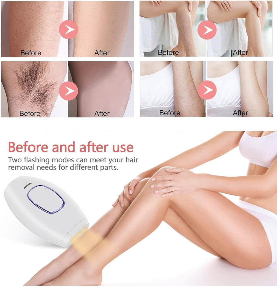 Home Use Beauty Device IPL Laser Hair Removal for Women and Men,999999 Flashes at-Home Laser Hair Removal Device