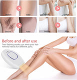 Home Use Beauty Device IPL Laser Hair Removal for Women and Men,999999 Flashes at-Home Laser Hair Removal Device